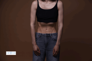 Thin woman in black top and jeans, symbolizing anorexia nervosa treatment and eating disorder recovery at Empower Health Group